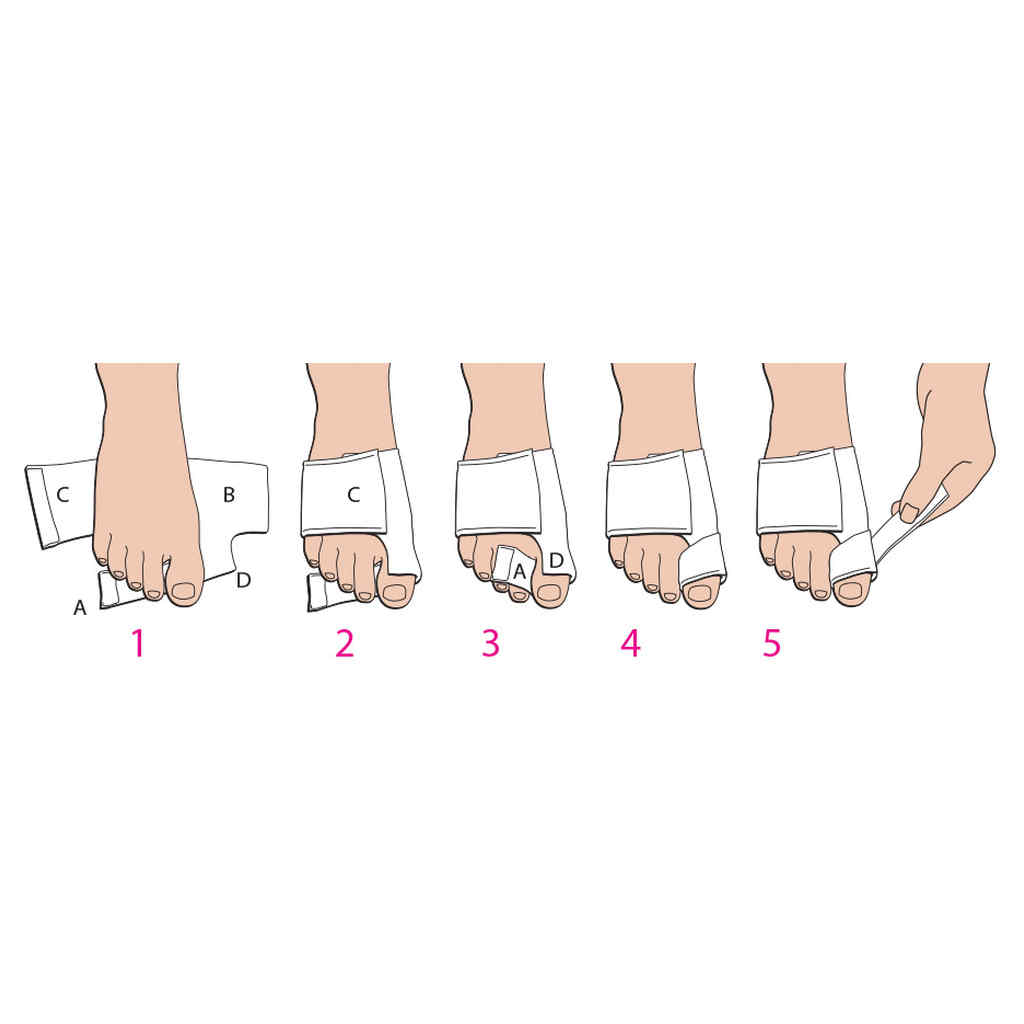 Bunion SoftSplint™ (#P6026-E)