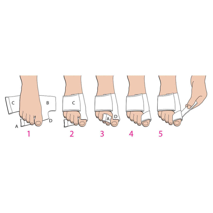 Bunion SoftSplint™ (#P6026-E)