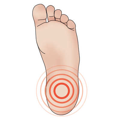 Foot Pain Chart: Top of Foot, Side and Front of Foot Pain Chart