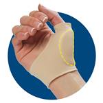 Splinting and Padding