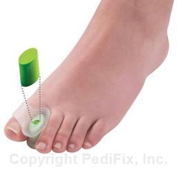 Visco-GEL® Customizables® Toe Spreaders™ (#1030-CTZ)