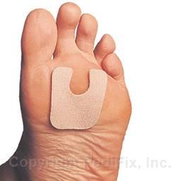 FELTastic® Callus Protectors (#P16)