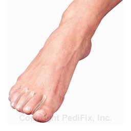 Visco-GEL® Toe Separators™ (#P31)