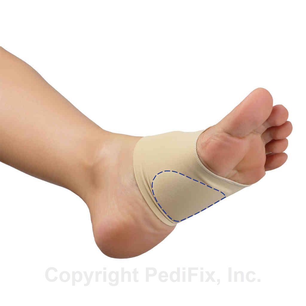Plantar fascia arch support Clearance