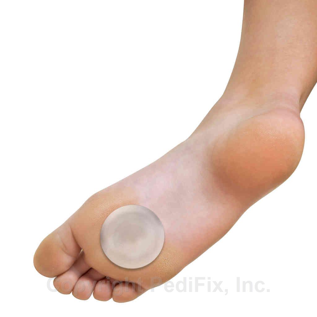 PediFix® Pedi-GEL® Reusable Callus Cushions - Main Image