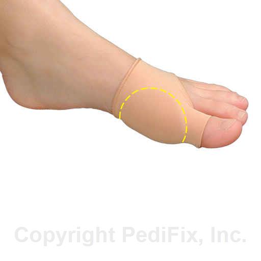 Click here to view larger image Visco-GEL® Bunion Relief Sleeve